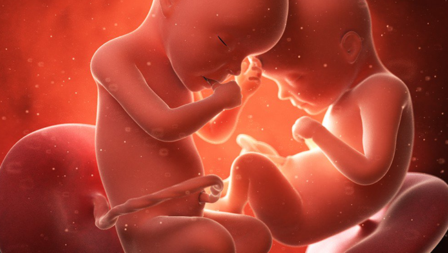 Почему приснился аборт